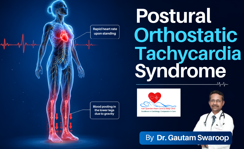 Medical illustration demonstrating Postural Orthostatic Tachycardia, showing rapid heart rate and blood pooling in the lower body upon standing.