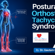 Medical illustration demonstrating Postural Orthostatic Tachycardia, showing rapid heart rate and blood pooling in the lower body upon standing.