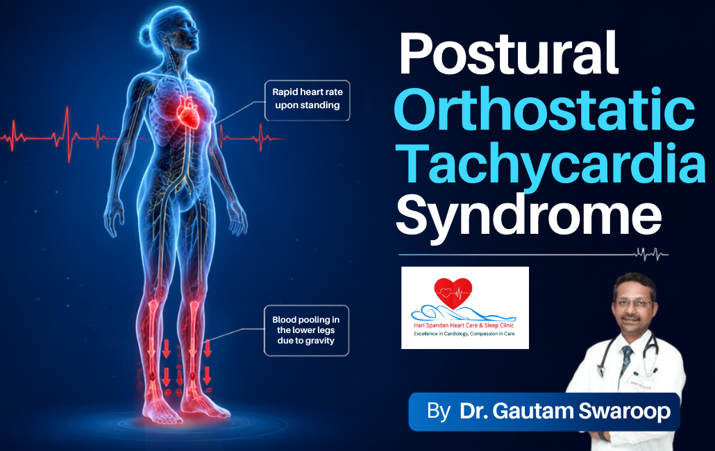 Medical illustration demonstrating Postural Orthostatic Tachycardia, showing rapid heart rate and blood pooling in the lower body upon standing.